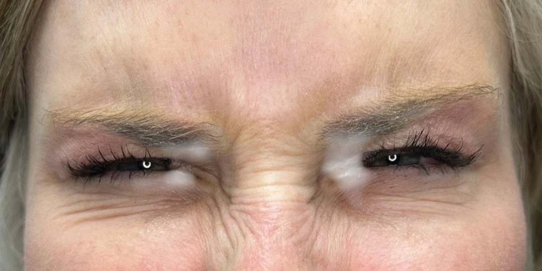 Bunny Lines Knoxville result 7 Before