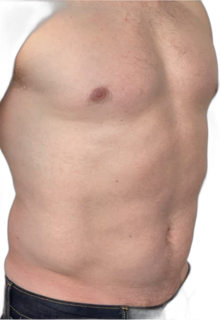 Treatment result 1 before