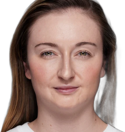 Under-Eye Filler after