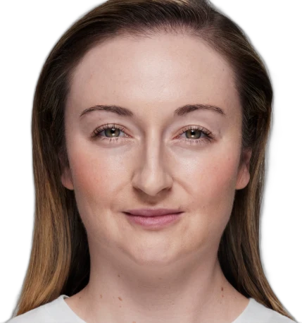 Under-Eye Filler before