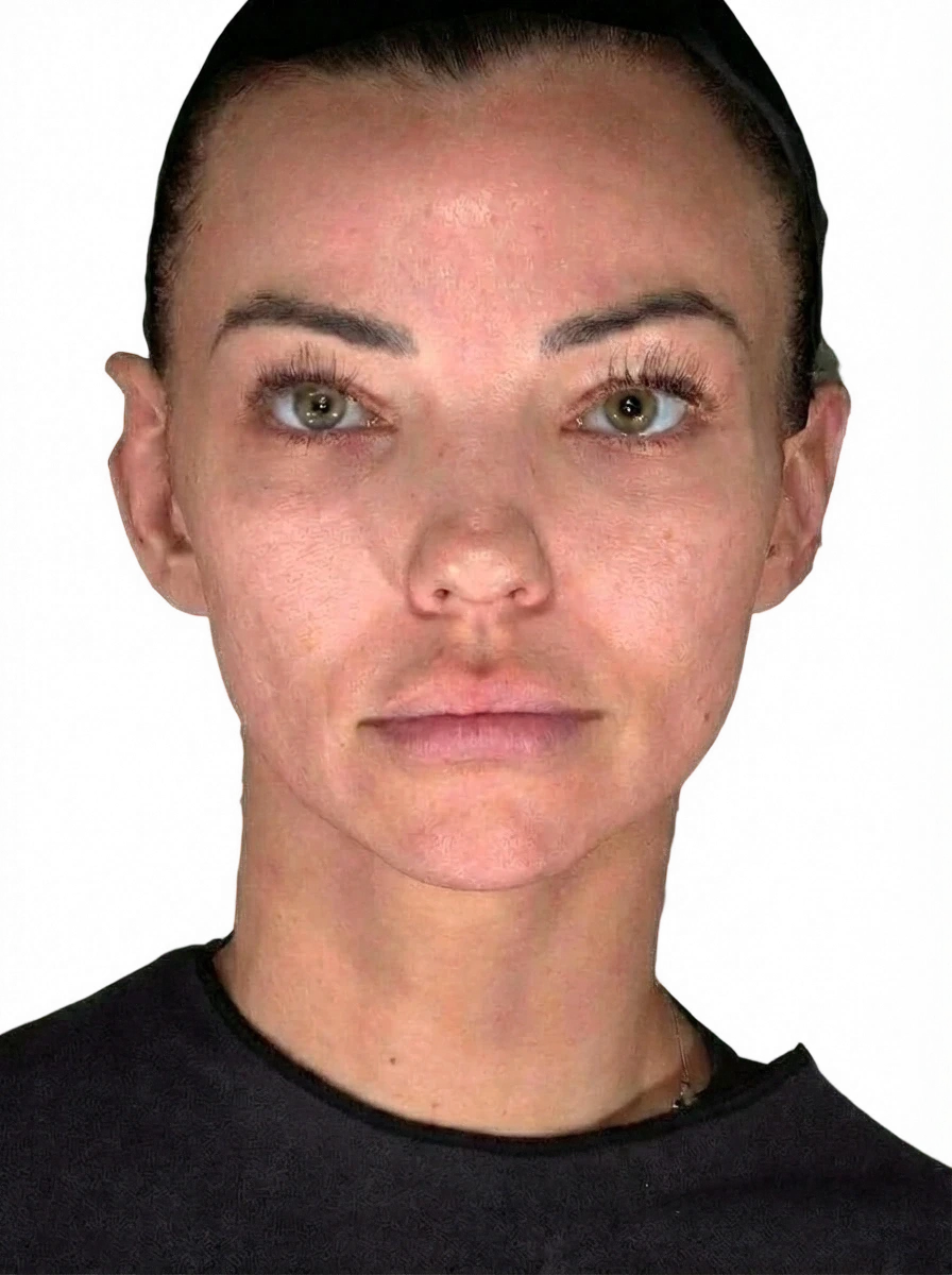 SkinVive Knoxville result 3 Before