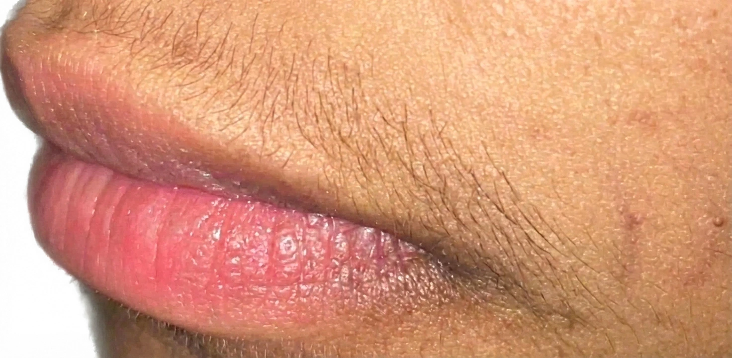 Laser Services before